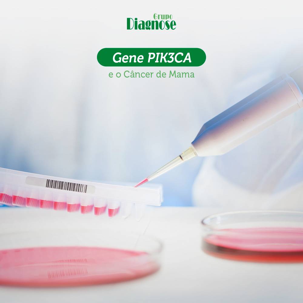 Gene PIK3CA e câncer de mama - Entenda a relação.